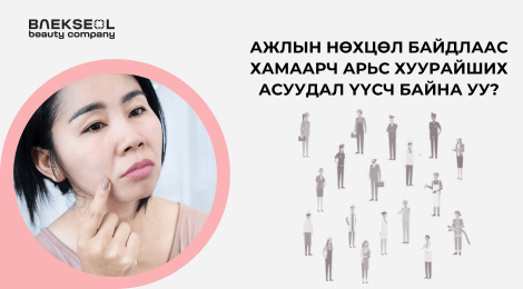 Ажлын нөхцөл байдлаас хамаарч хуурай арьстай болох шалтгаан үүсч болно